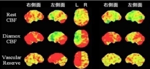 核医学