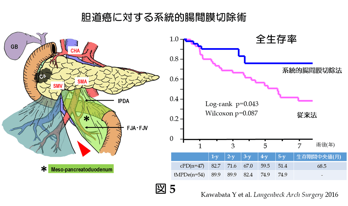 胆道癌に対する系統的腸間膜切除術