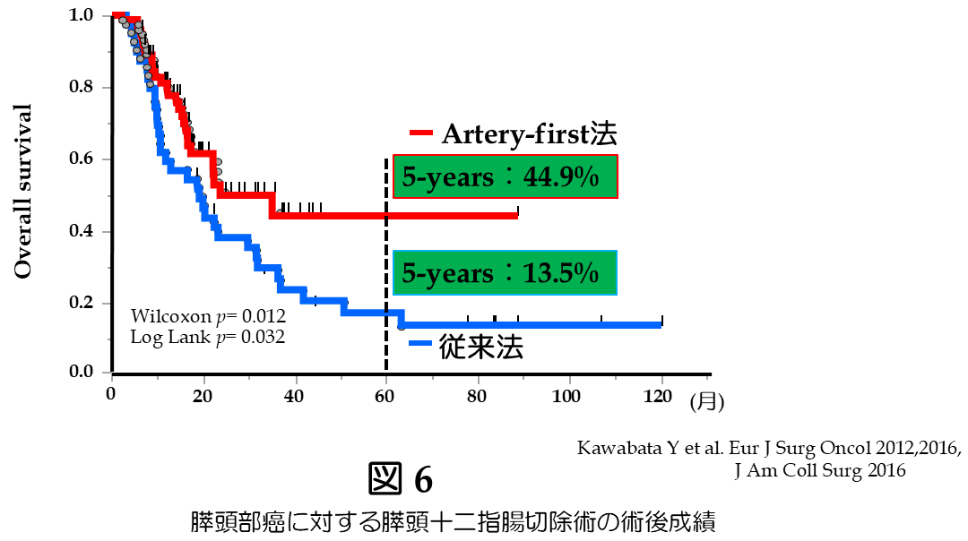 胆道癌に対する系統的腸間膜切除術